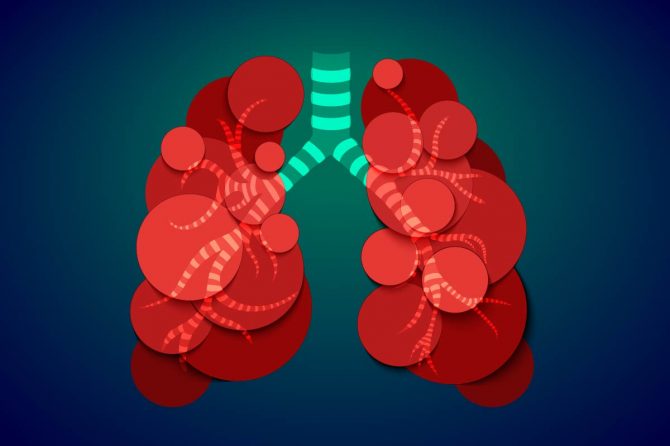 Living with asthma – the right way to use your inhalers.